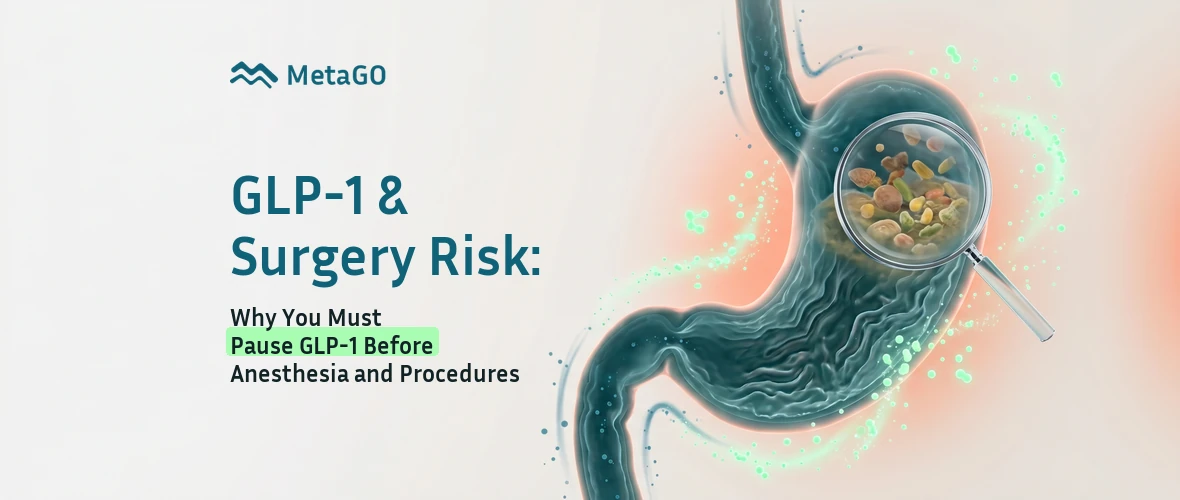 GLP-1 and surgery risk illustration: stomach with delayed food emptying under magnifier explaining anesthesia pause guidance